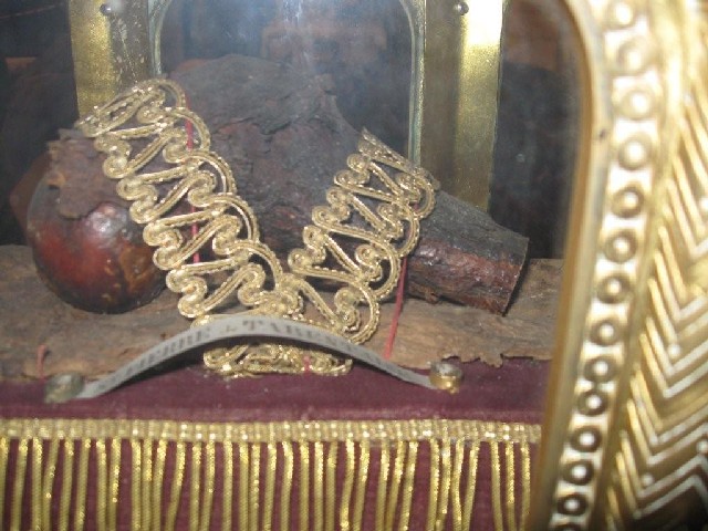 spt cirey - tête du fémur