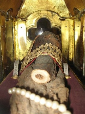 SPT Cirey - Tête du fémur - 2