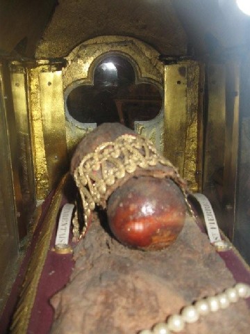 SPT Cirey - Tête du fémur - 3