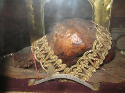 SPT Cirey - Tête du fémur - 4