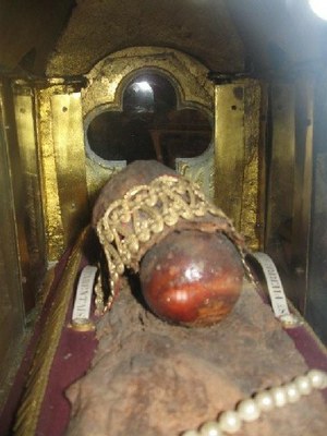 SPT Cirey - Tête du fémur - 3